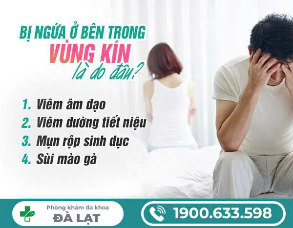Hình ảnh minh họa